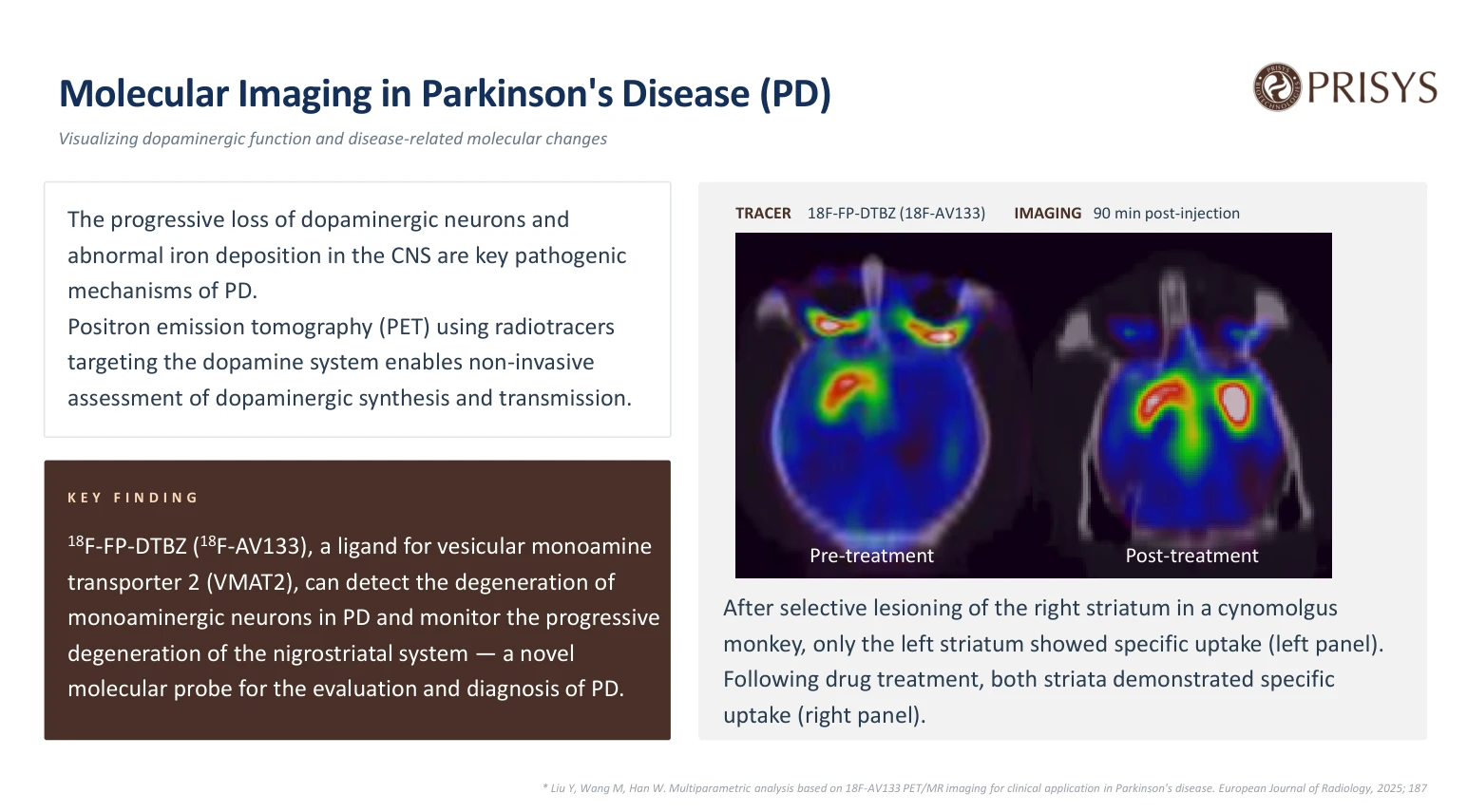 Molecular Imaging in Parkinson's Disease (PD) Visualizing dopaminergic function and disease-related molecular changes