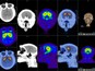NHP Neuroscience