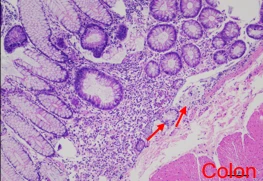 Inflammatory Bowel Disease Nonhuman Primates Disease Model