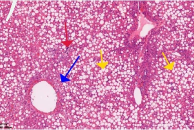 NHP Non-Alcoholic Steatohepatitis (NASH) Model