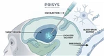 NHP Intracerebral Injection (ICM) Services | Prisys Biotech