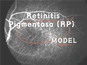 Retinitis Pigmentosa (RP) NHP Model